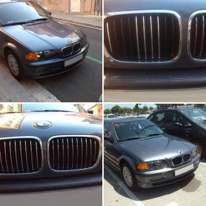 Riñones BMW